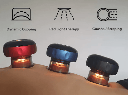 SmartCup - Red Light & Heat Cupping Therapy Massager - Infigenics