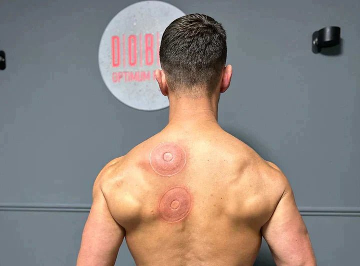 SmartCup - Red Light & Heat Cupping Therapy Massager - Infigenics