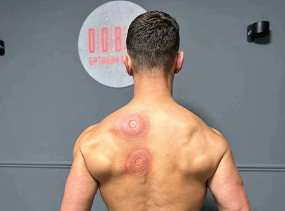 SmartCup - Red Light & Heat Cupping Therapy Massager - Infigenics